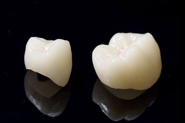 1.自然な歯を作る精密補綴（ほてつ）技術
